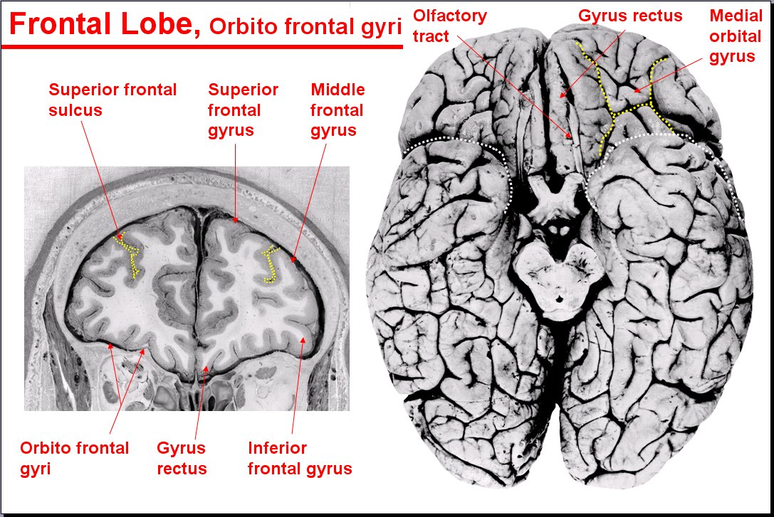 Salamons Neuroanatomy And Neurovasculature Web Atlas Resource